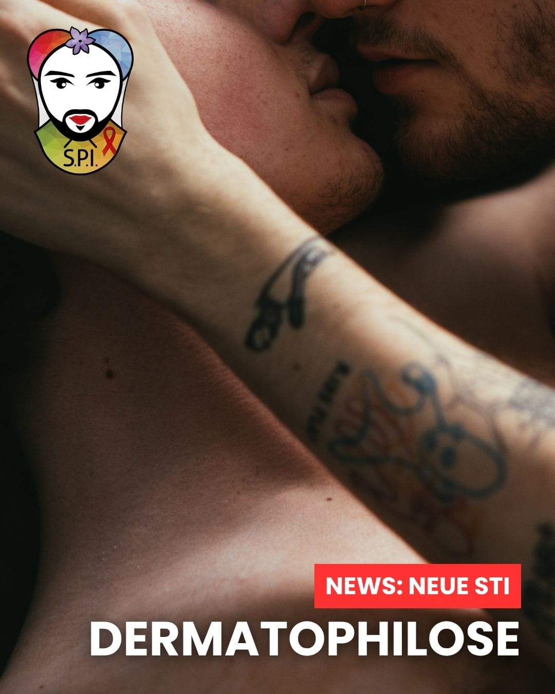 Dermatophilose - Eine neue Herausforderung